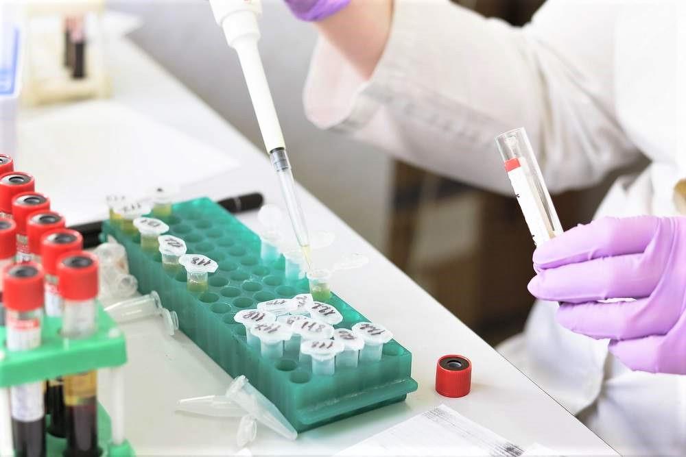 urnik-testiranja-s-hitrim-antigenskim-testom-na-korona-virus-covid-19-v-grosupljem-v-tednu-od-30-8-do-5-9.-2021